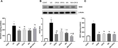 The novel anti-colitic effect of β-adrenergic receptors via modulation of PS1/BACE-1/Aβ axis and NOTCH signaling in an ulcerative colitis model